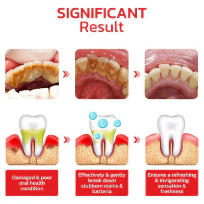✨SP-4 Probiotic Brightening & Stain Removing Toothpaste 🦷